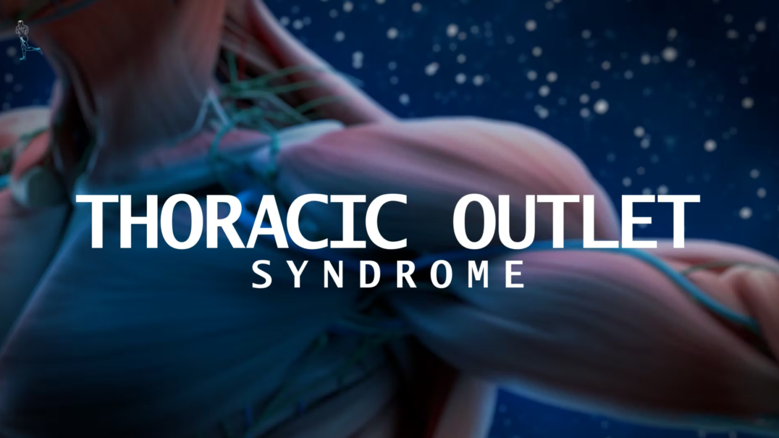 Thoracic Outlet Syndrome Course